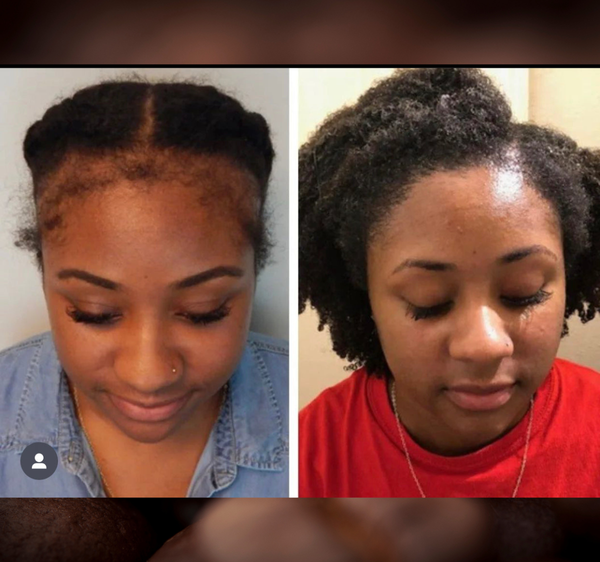 Batana Oil 2oz (Dr.Sebi Approved Hair growth Miracle Oil For Alopecia)