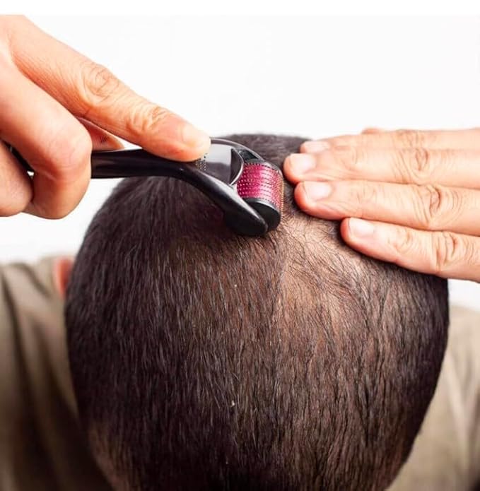 Derma Roller: Stimulate Hair Growth and Boost Scalp Health