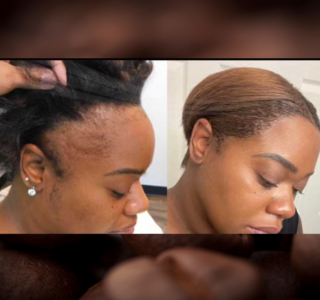 Batana Oil 2oz (Dr.Sebi Approved Hair growth Miracle Oil For Alopecia)