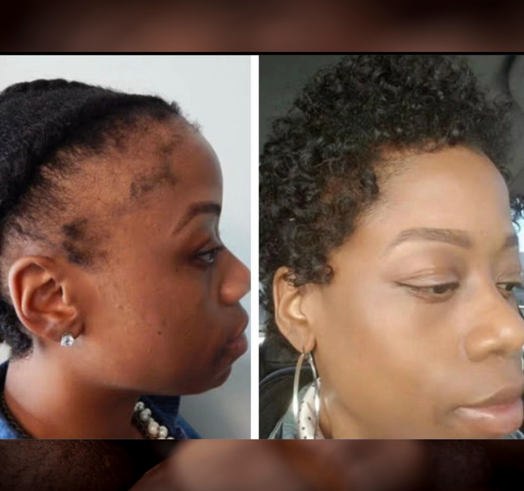 Batana Oil 2oz (Dr.Sebi Approved Hair growth Miracle Oil For Alopecia)