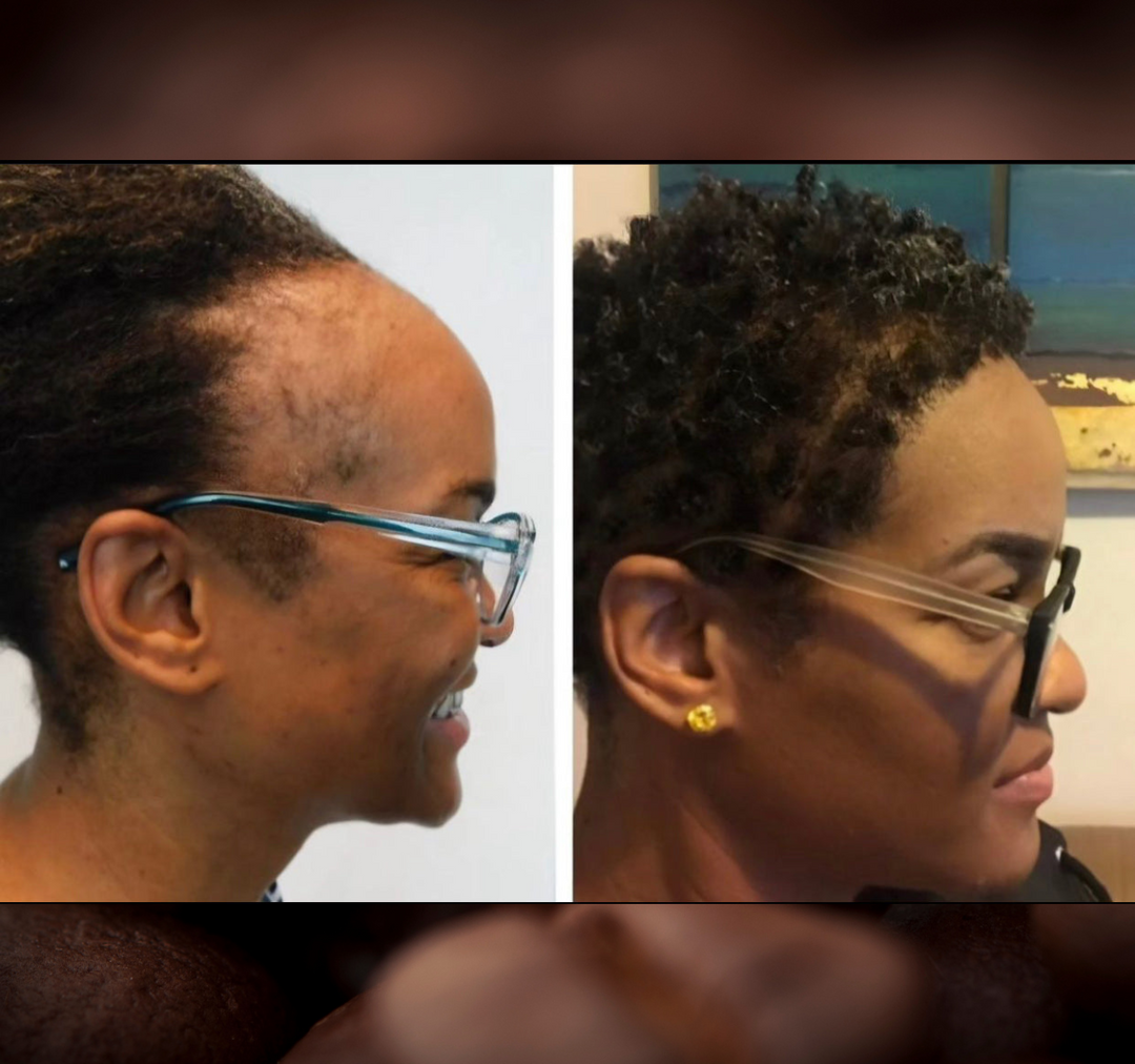 Batana Oil 2oz (Dr.Sebi Approved Hair growth Miracle Oil For Alopecia)
