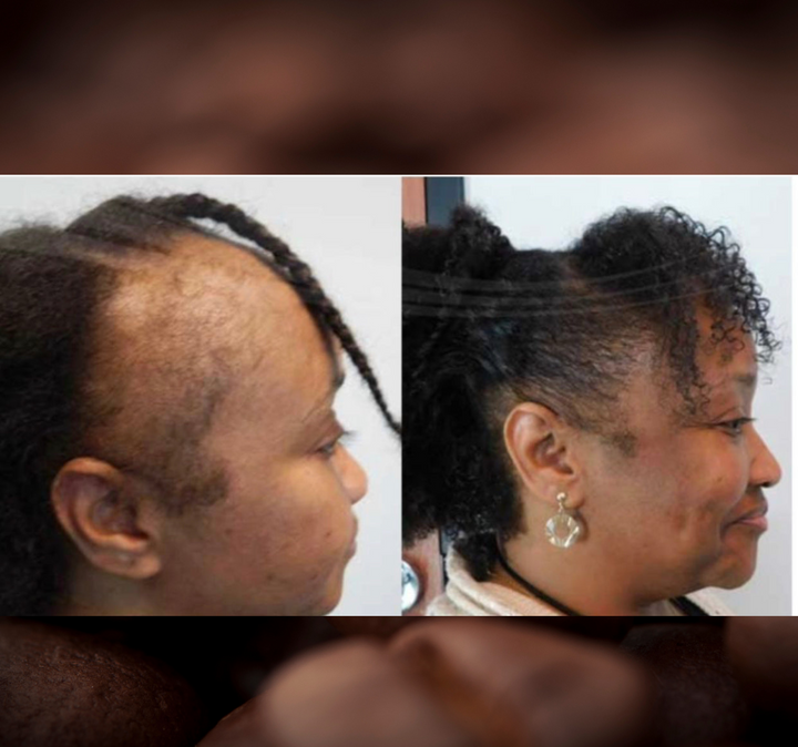 Batana Oil 2oz (Dr.Sebi Approved Hair growth Miracle Oil For Alopecia)